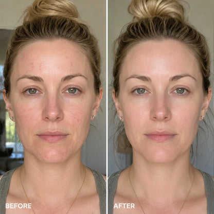 7-In-1 LED Face Mask for Brighter, Smoother, Healthier-Looking Skin